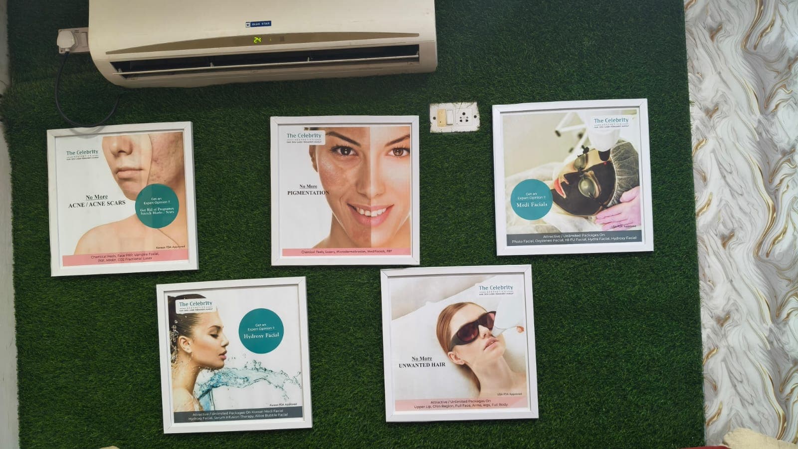 Wall of clinical specialty posters at Crown Celebrity Aesthetic: Acne, Pigmentation, Medi Facials, Hydroxy, and Laser Hair Removal